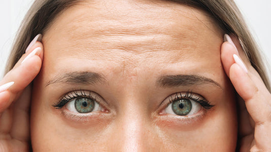 Wrinkles on woman's forehead