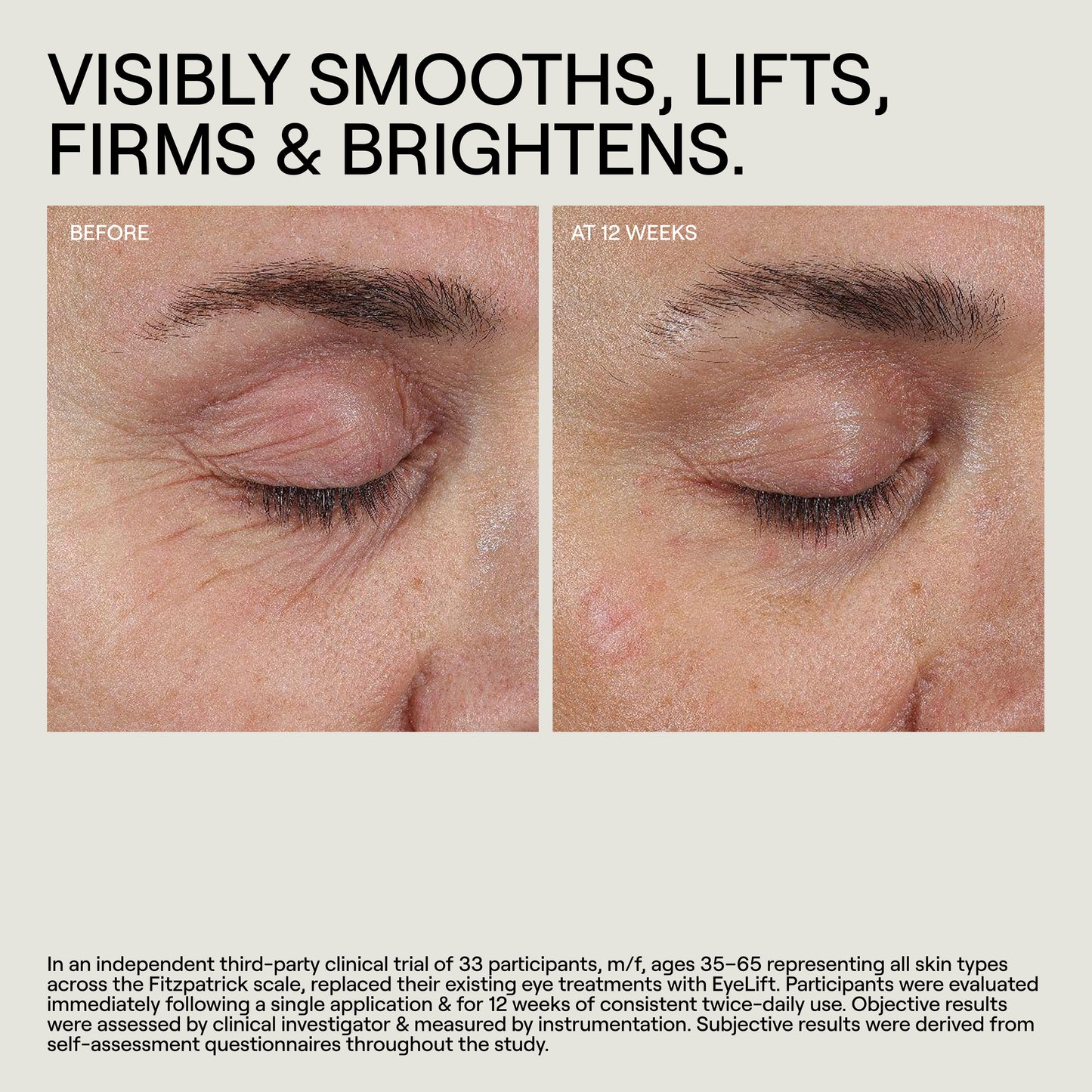 Before and after comparison of eye treatment on skin with text indicating benefits.