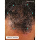 Nutrafol Men - Hair Growth Pack - After